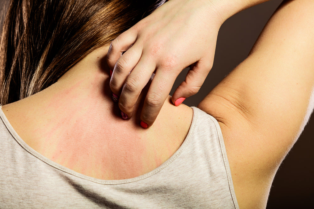 dealing with itchy skin after massage