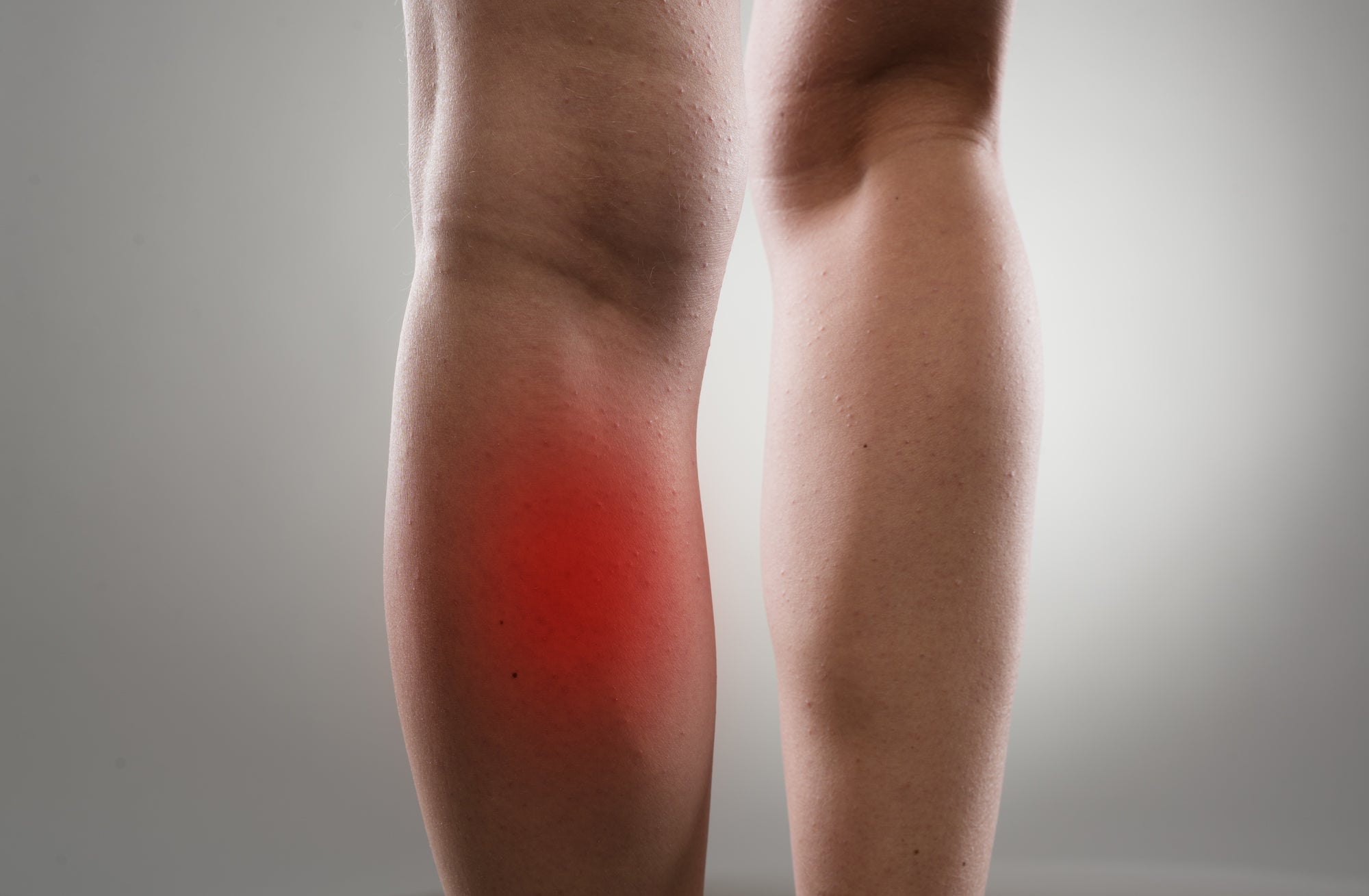 Simple Solutions for Stiff Calves: Tips for Prevention and Relief